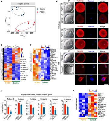 Molecular Features of Polycystic Ovary Syndrome Revealed by Transcriptome Analysis of Oocytes and Cumulus Cells